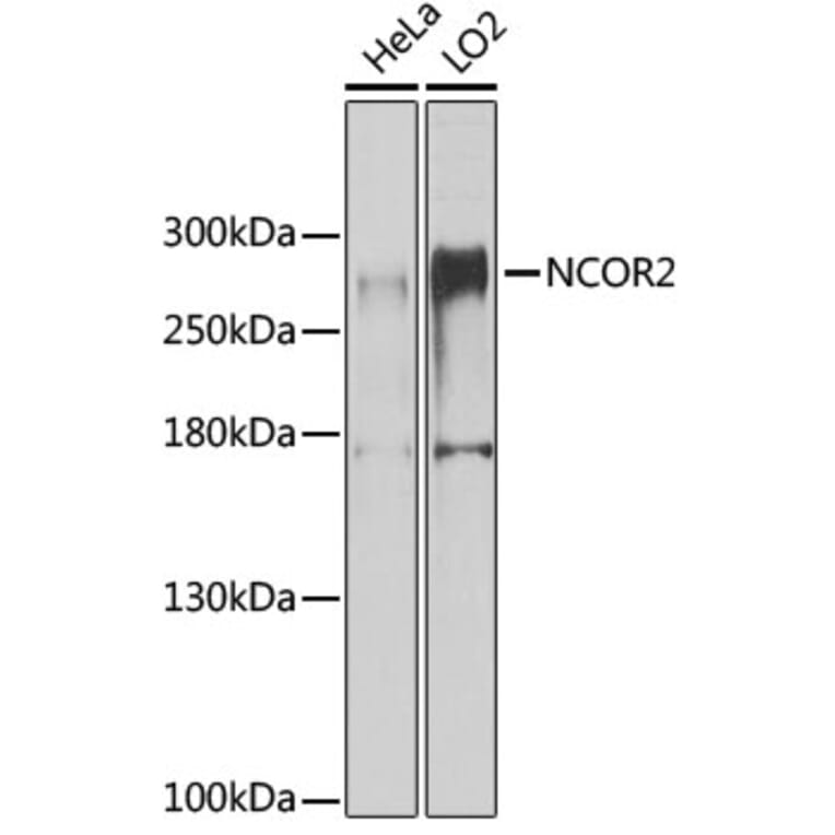 Western Blot - Anti-NCOR2/SMRT Antibody (A10415) - Antibodies.com