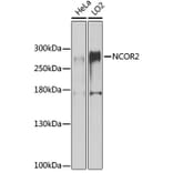 Western Blot - Anti-NCOR2/SMRT Antibody (A10415) - Antibodies.com