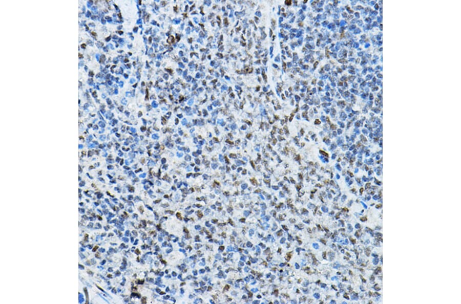 Immunohistochemistry - Anti-NCOR2/SMRT Antibody (A10415) - Antibodies.com