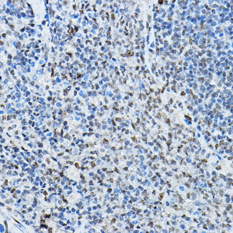Immunohistochemistry - Anti-NCOR2/SMRT Antibody (A10415) - Antibodies.com
