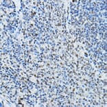 Immunohistochemistry - Anti-NCOR2/SMRT Antibody (A10415) - Antibodies.com