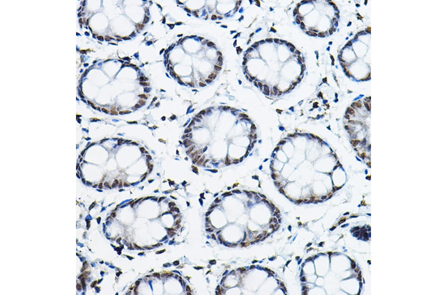 Immunohistochemistry - Anti-NCOR2/SMRT Antibody (A10415) - Antibodies.com