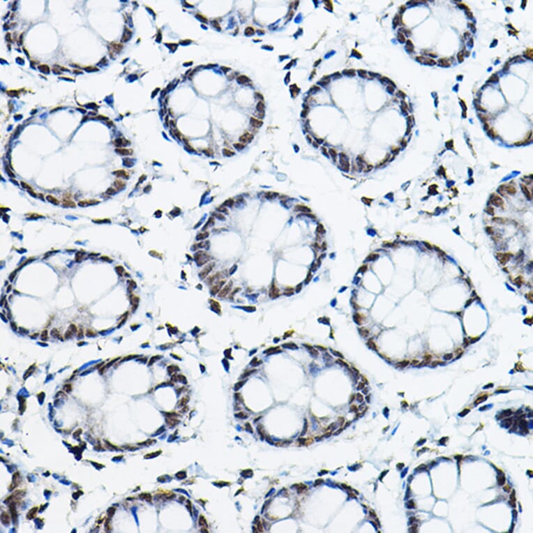 Immunohistochemistry - Anti-NCOR2/SMRT Antibody (A10415) - Antibodies.com