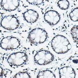 Immunohistochemistry - Anti-NCOR2/SMRT Antibody (A10415) - Antibodies.com