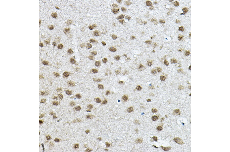 Immunohistochemistry - Anti-NCOR2/SMRT Antibody (A10415) - Antibodies.com