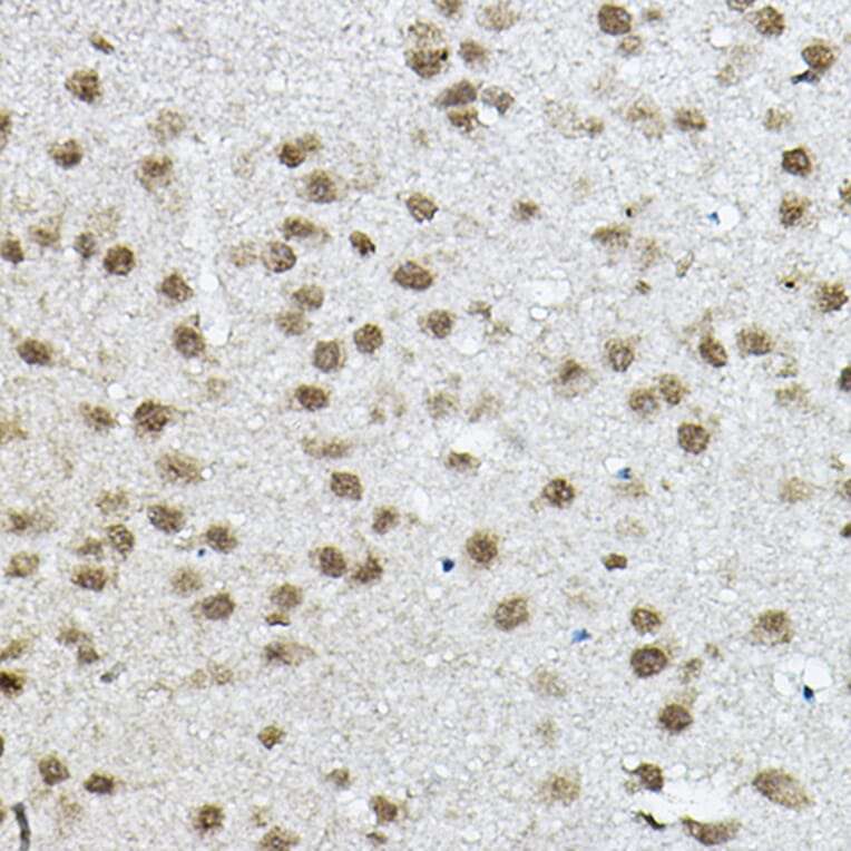 Immunohistochemistry - Anti-NCOR2/SMRT Antibody (A10415) - Antibodies.com
