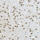 Immunohistochemistry - Anti-NCOR2/SMRT Antibody (A10415) - Antibodies.com