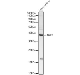 Western Blot - Anti-AGXT Antibody (A10417) - Antibodies.com