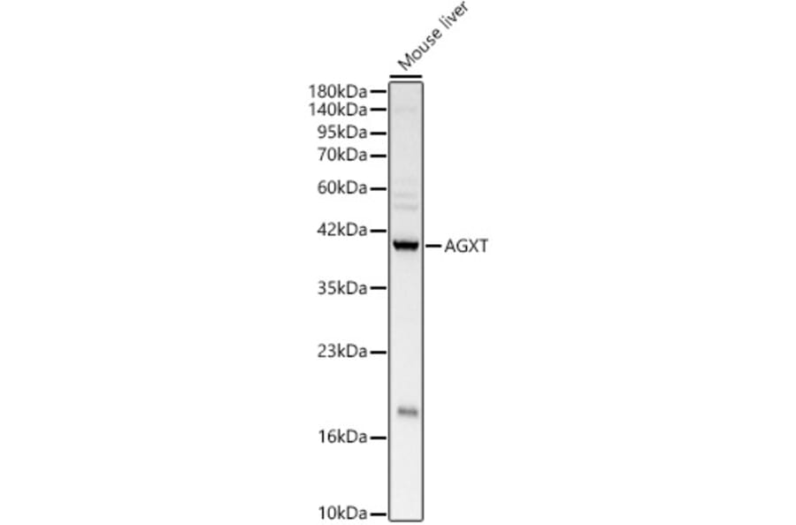 Western Blot - Anti-AGXT Antibody (A10417) - Antibodies.com