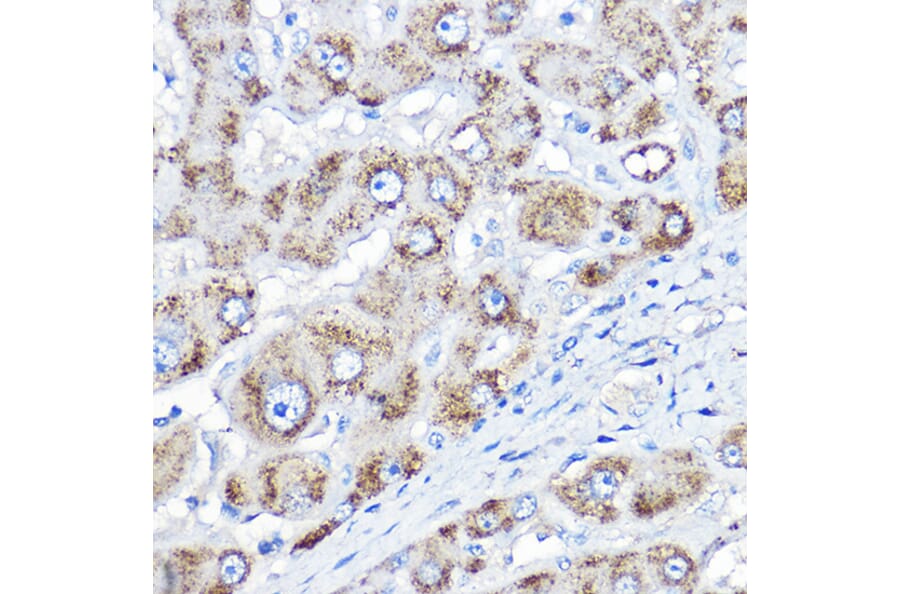 Immunohistochemistry - Anti-AGXT Antibody (A10417) - Antibodies.com