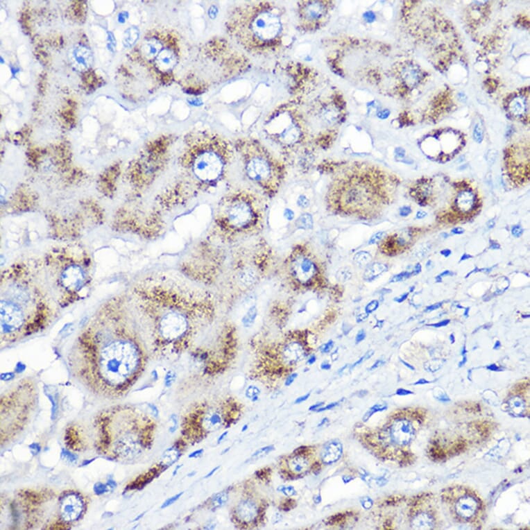 Immunohistochemistry - Anti-AGXT Antibody (A10417) - Antibodies.com