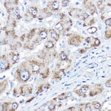 Immunohistochemistry - Anti-AGXT Antibody (A10417) - Antibodies.com
