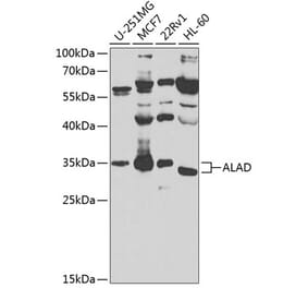 Western Blot - Anti-ALAD Antibody (A10418) - Antibodies.com