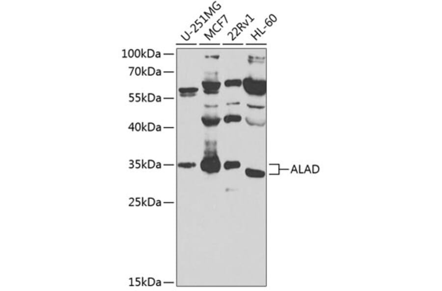 Western Blot - Anti-ALAD Antibody (A10418) - Antibodies.com