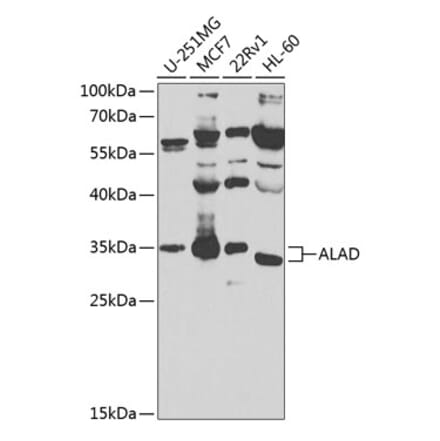 Western Blot - Anti-ALAD Antibody (A10418) - Antibodies.com