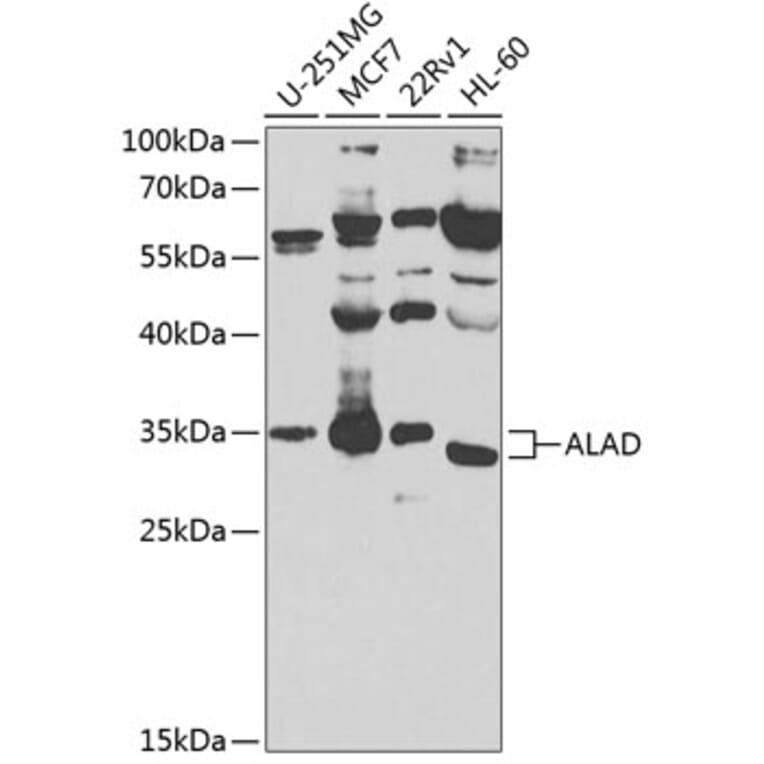 Western Blot - Anti-ALAD Antibody (A10418) - Antibodies.com