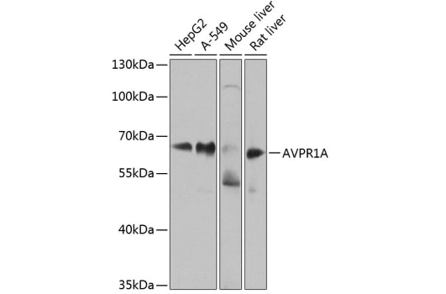 Western Blot - Anti-AVPR1A/V1aR Antibody (A10419) - Antibodies.com