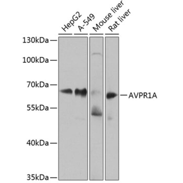 Western Blot - Anti-AVPR1A/V1aR Antibody (A10419) - Antibodies.com