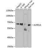Western Blot - Anti-AVPR1A/V1aR Antibody (A10419) - Antibodies.com