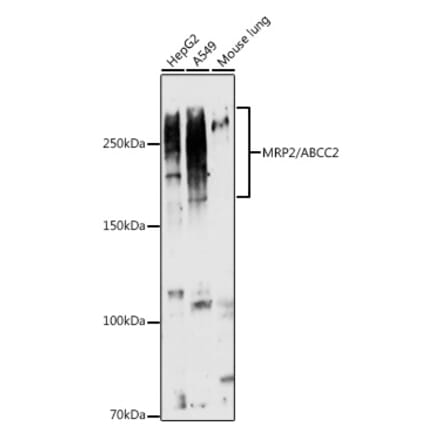 Western Blot - Anti-MRP2 Antibody (A10420) - Antibodies.com