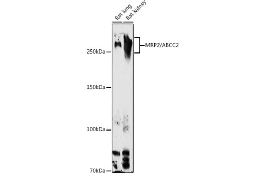 Western Blot - Anti-MRP2 Antibody (A10420) - Antibodies.com