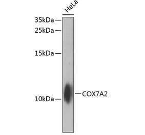 Western Blot - Anti-COX7A2 Antibody (A10421) - Antibodies.com
