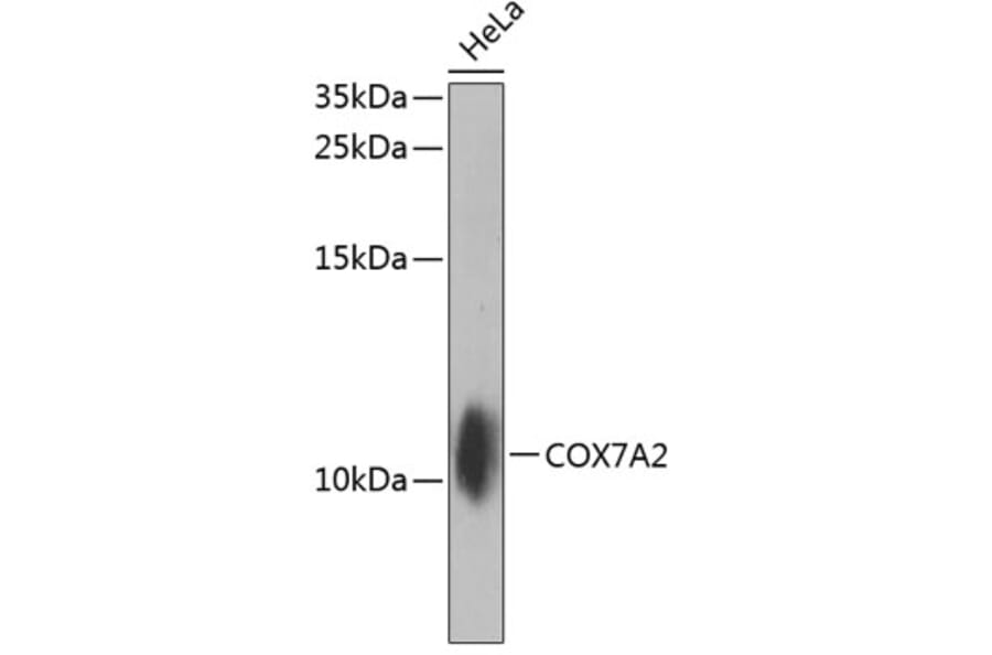 Western Blot - Anti-COX7A2 Antibody (A10421) - Antibodies.com