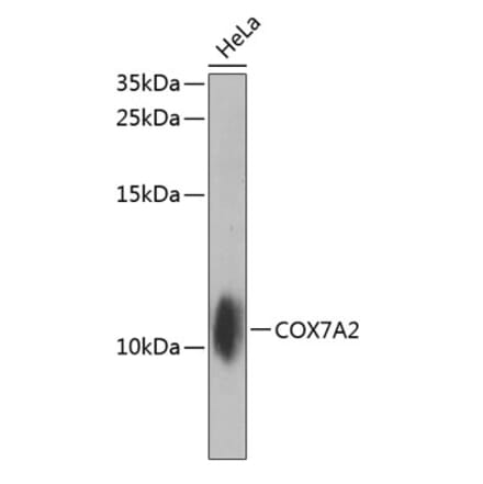 Western Blot - Anti-COX7A2 Antibody (A10421) - Antibodies.com