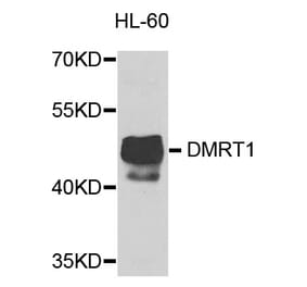 Western Blot - Anti-DMRT1 Antibody (A8411) - Antibodies.com