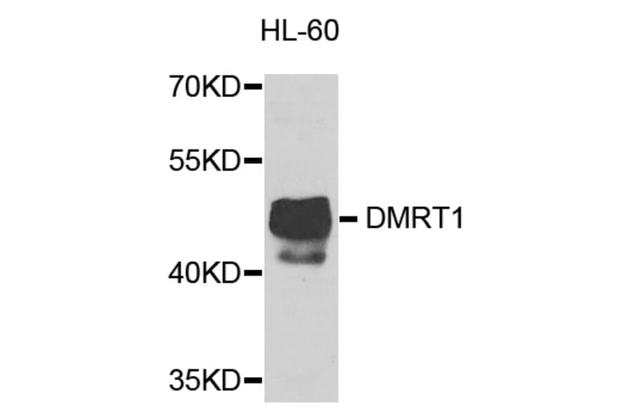 Western Blot - Anti-DMRT1 Antibody (A8411) - Antibodies.com