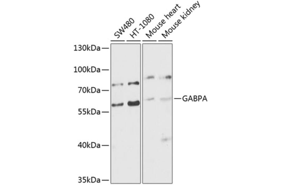 Western Blot - Anti-GABPA Antibody (A10423) - Antibodies.com