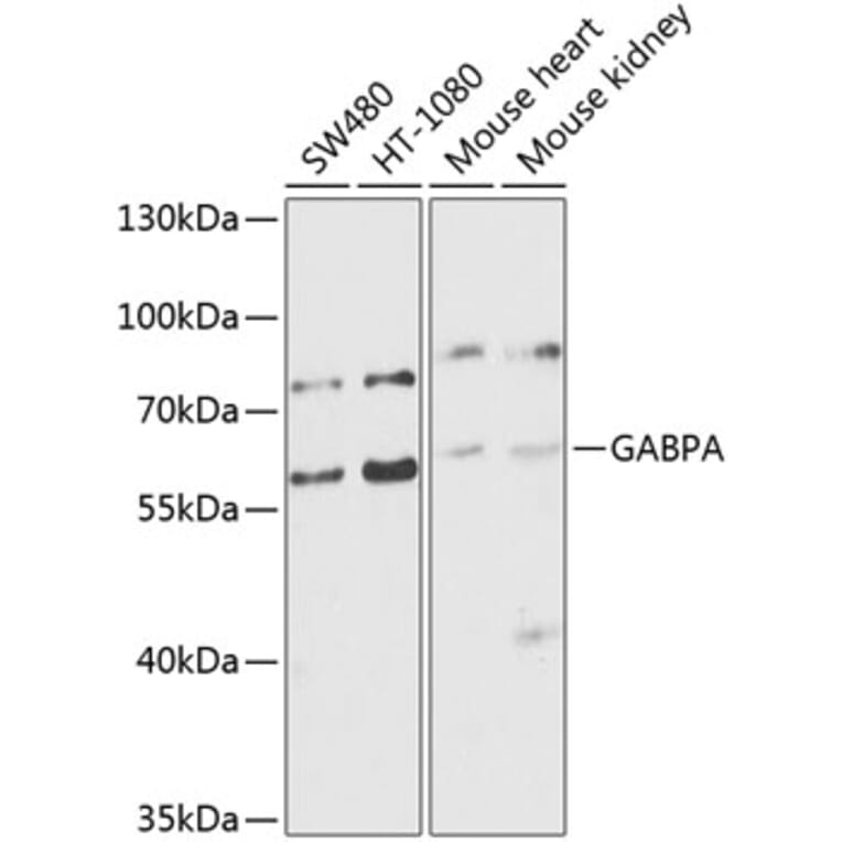 Western Blot - Anti-GABPA Antibody (A10423) - Antibodies.com