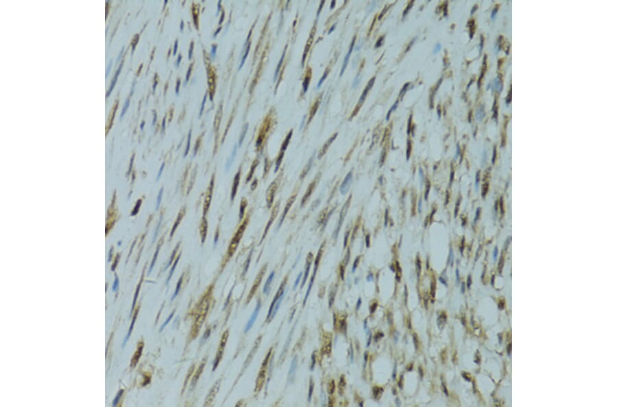 Immunohistochemistry - Anti-GABPA Antibody (A10423) - Antibodies.com