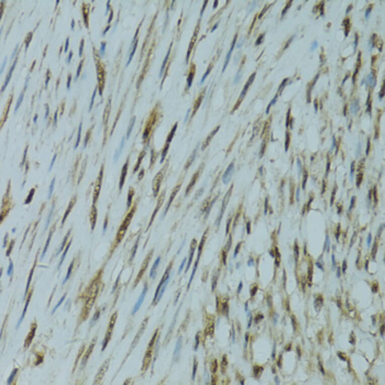Immunohistochemistry - Anti-GABPA Antibody (A10423) - Antibodies.com