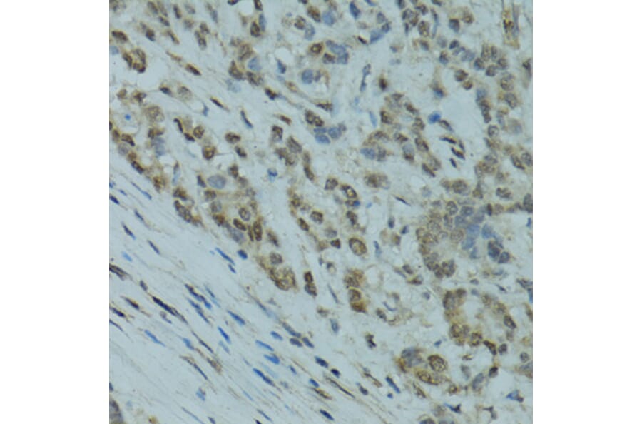 Immunohistochemistry - Anti-GABPA Antibody (A10423) - Antibodies.com