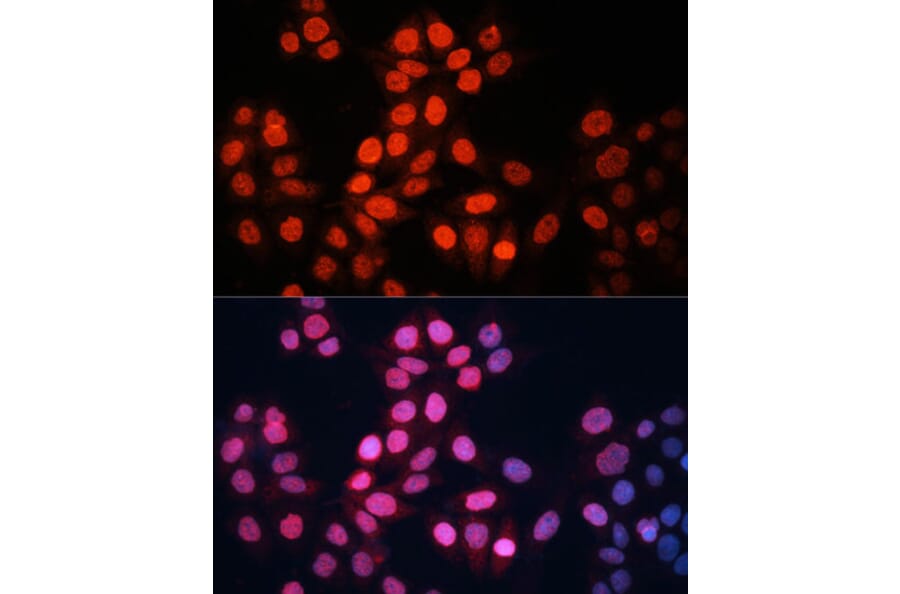 Immunofluorescence - Anti-GABPA Antibody (A10423) - Antibodies.com