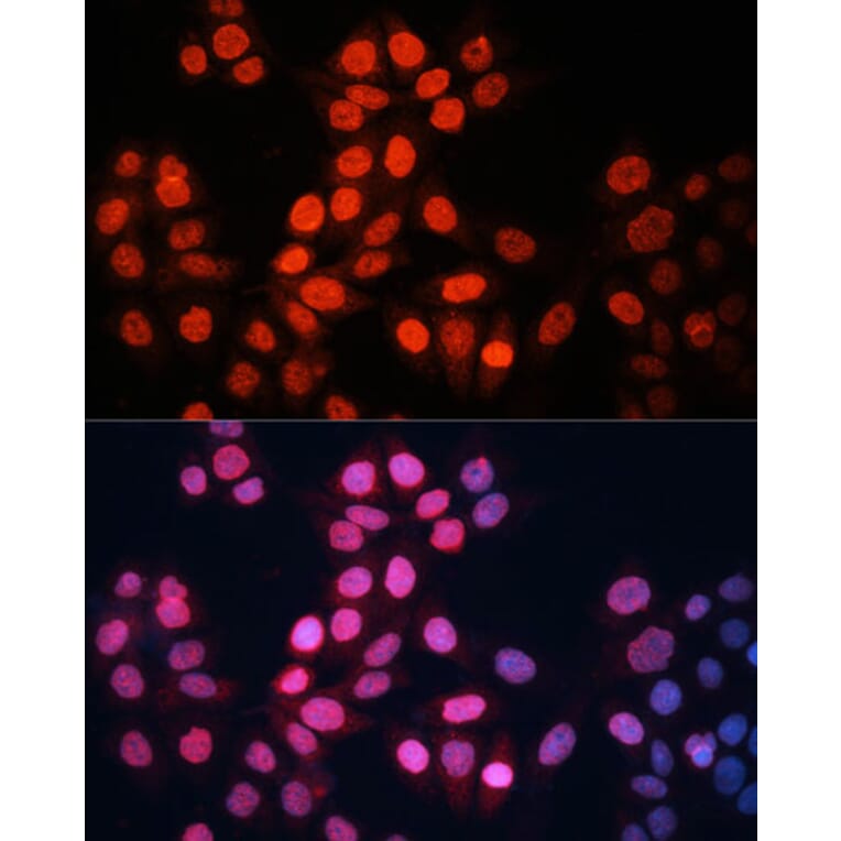 Immunofluorescence - Anti-GABPA Antibody (A10423) - Antibodies.com
