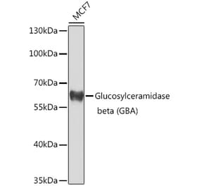 Western Blot - Anti-GBA Antibody (A10424) - Antibodies.com