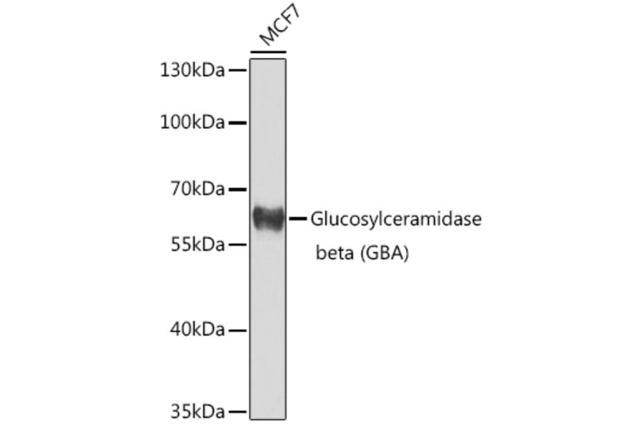 Western Blot - Anti-GBA Antibody (A10424) - Antibodies.com