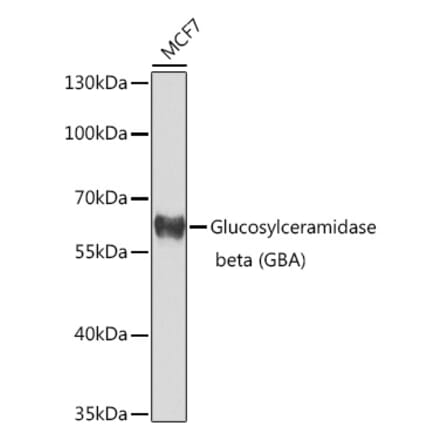 Western Blot - Anti-GBA Antibody (A10424) - Antibodies.com
