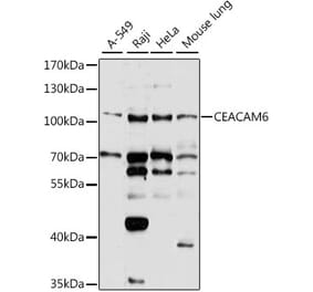 Western Blot - Anti-CEACAM6 Antibody (A8440) - Antibodies.com