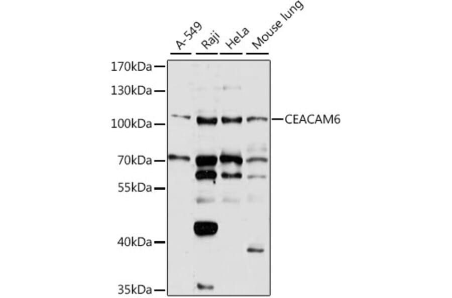 Western Blot - Anti-CEACAM6 Antibody (A8440) - Antibodies.com