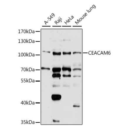 Western Blot - Anti-CEACAM6 Antibody (A10425) - Antibodies.com
