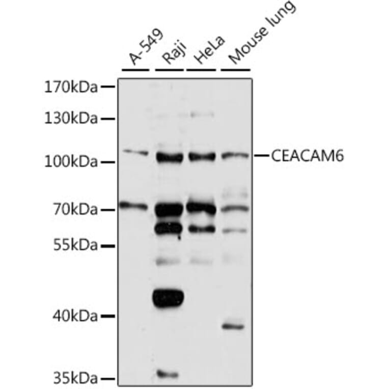 Western Blot - Anti-CEACAM6 Antibody (A8440) - Antibodies.com