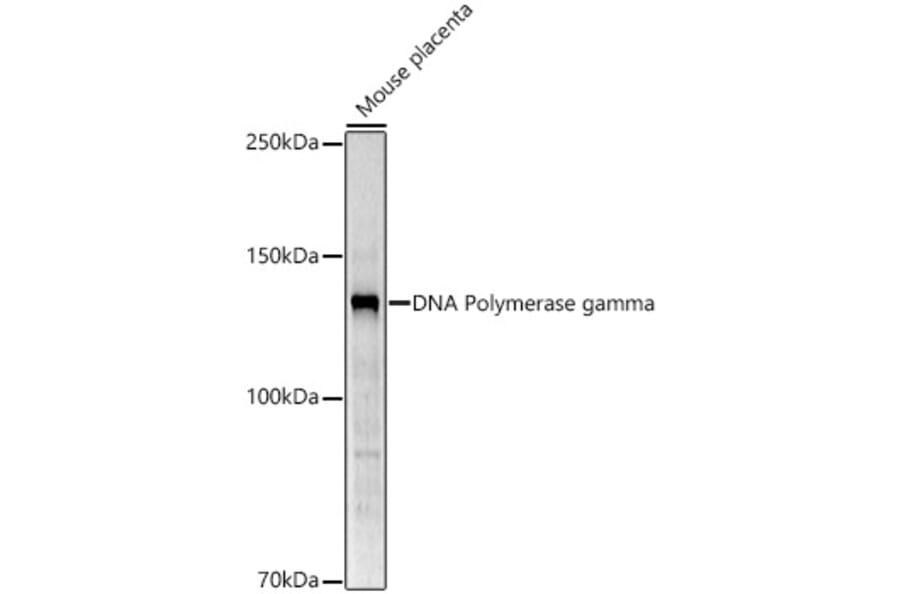 Western Blot - Anti-POLG Antibody (A10426) - Antibodies.com