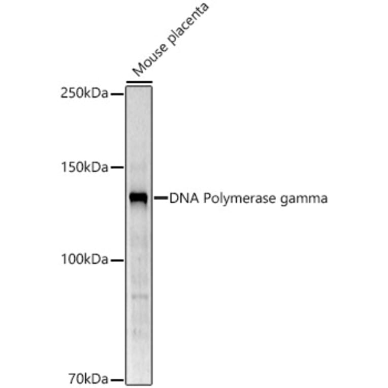 Western Blot - Anti-POLG Antibody (A10426) - Antibodies.com