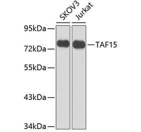 Western Blot - Anti-TAF15 Antibody (A10428) - Antibodies.com