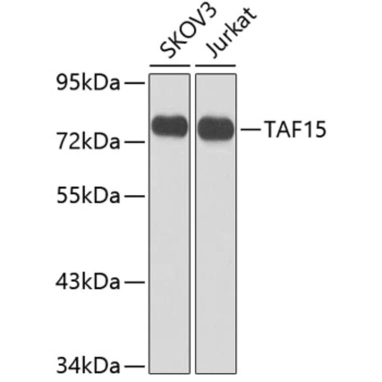 Western Blot - Anti-TAF15 Antibody (A10428) - Antibodies.com