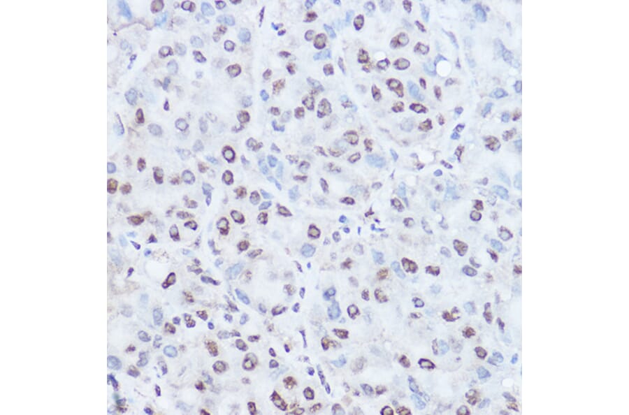 Immunohistochemistry - Anti-TAF15 Antibody (A10428) - Antibodies.com