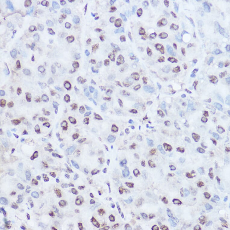 Immunohistochemistry - Anti-TAF15 Antibody (A10428) - Antibodies.com